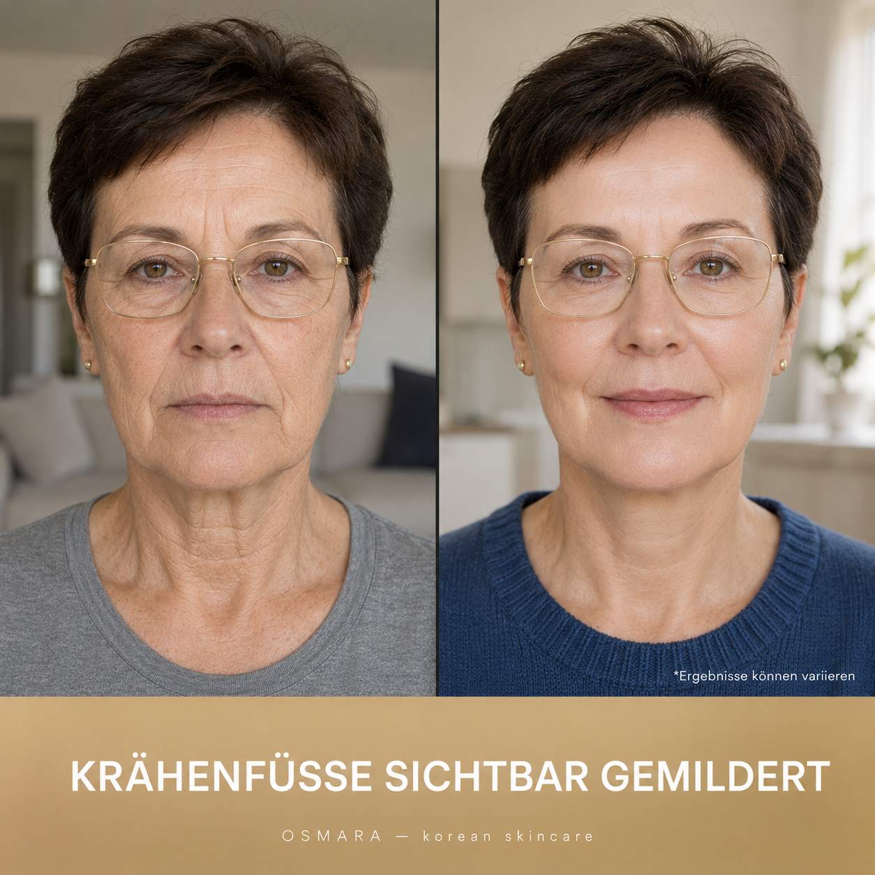 Osmara– Koreanisches Serum mit Lifting-Effekt schon ab der ersten Anwendung