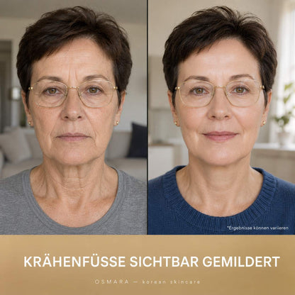 Osmara– Koreanisches Serum mit Lifting-Effekt schon ab der ersten Anwendung