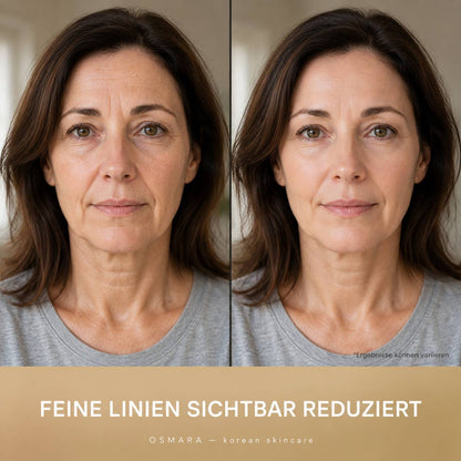 Osmara– Koreanisches Serum mit Lifting-Effekt schon ab der ersten Anwendung