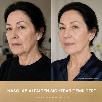 Osmara– Koreanisches Serum mit Lifting-Effekt schon ab der ersten Anwendung